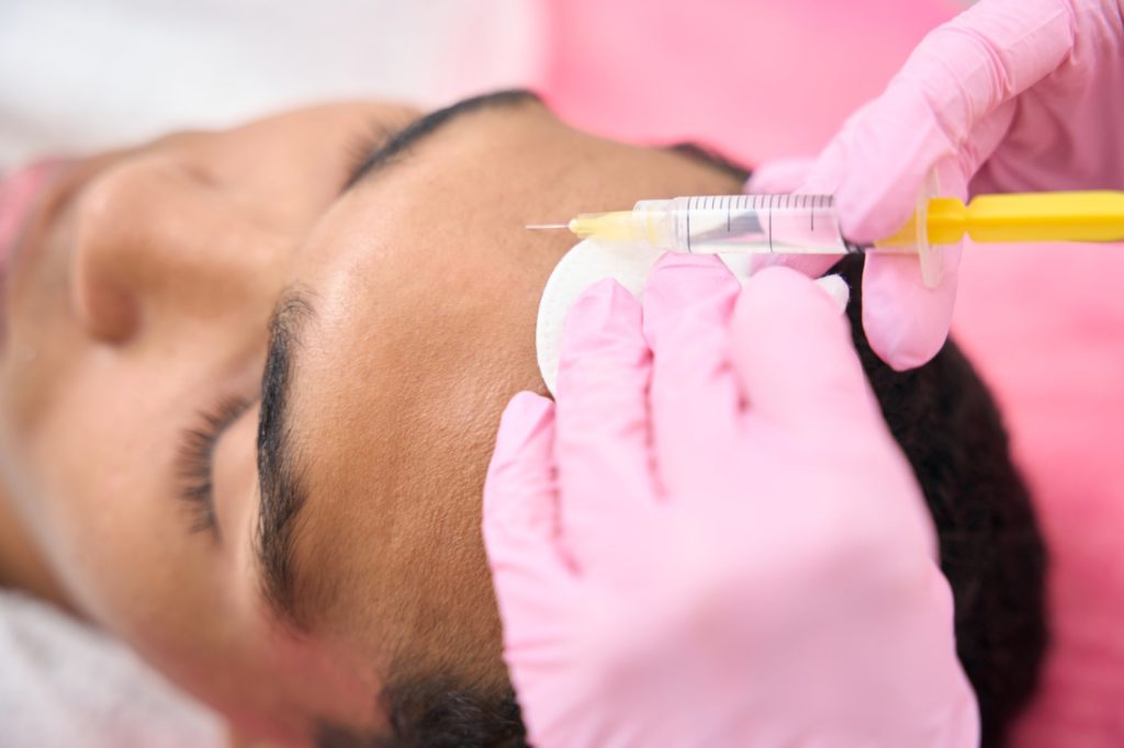 Chalazion